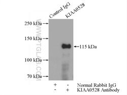 KIAA0528 Rabbit anti-Human, Mouse, Rat, Polyclonal, Proteintech 150 &mu;L;