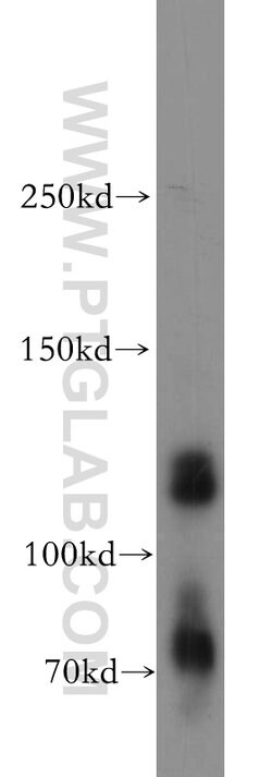 KIAA0528 Rabbit anti-Human, Mouse, Rat, Polyclonal, Proteintech 150 &mu;L;