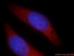 LARS Rabbit anti-Human, Mouse, Rat, Polyclonal, Proteintech 150 μL;