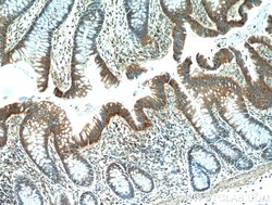 LARS Rabbit anti-Human, Mouse, Rat, Polyclonal, Proteintech 150 μL;