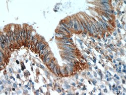 LARS Rabbit anti-Human, Mouse, Rat, Polyclonal, Proteintech 150 μL;