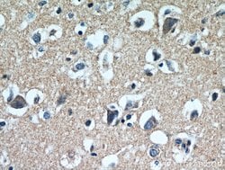 LARS Rabbit anti-Human, Mouse, Rat, Polyclonal, Proteintech 150 μL;