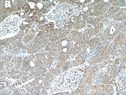 LARS Rabbit anti-Human, Mouse, Rat, Polyclonal, Proteintech 150 μL;