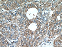 LARS Rabbit anti-Human, Mouse, Rat, Polyclonal, Proteintech 150 μL;