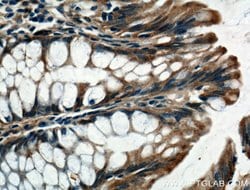 LARS Rabbit anti-Human, Mouse, Rat, Polyclonal, Proteintech 150 μL;