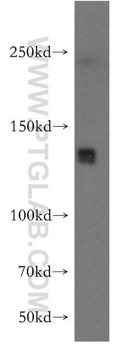 LARS Rabbit anti-Human, Mouse, Rat, Polyclonal, Proteintech 150 μL;
