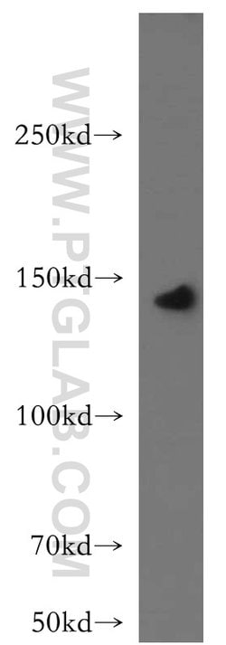 LARS Rabbit anti-Human, Mouse, Rat, Polyclonal, Proteintech 150 μL;