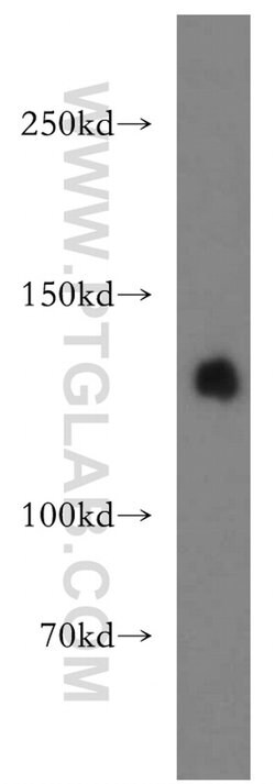 LARS Rabbit anti-Human, Mouse, Rat, Polyclonal, Proteintech 150 μL;