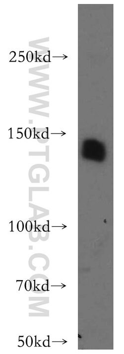 LARS Rabbit anti-Human, Mouse, Rat, Polyclonal, Proteintech 150 μL;