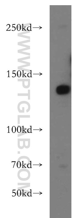 LARS Rabbit anti-Human, Mouse, Rat, Polyclonal, Proteintech 150 μL;