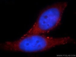 SLITRK6 Rabbit anti-Human, Mouse, Rat, Polyclonal, Proteintech 150 μL;