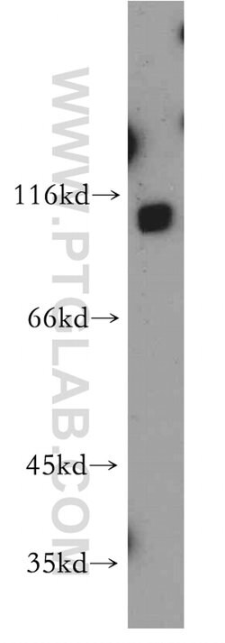 SLITRK6 Rabbit anti-Human, Mouse, Rat, Polyclonal, Proteintech 150 μL;