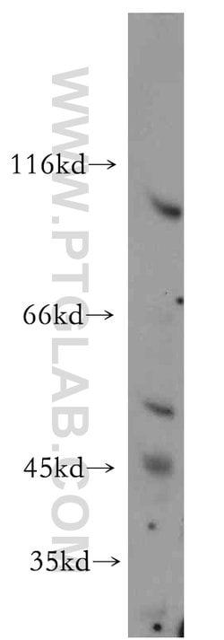 SLITRK6 Rabbit anti-Human, Mouse, Rat, Polyclonal, Proteintech 150 μL;