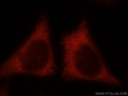 KIR2DS4 Rabbit anti-Human, Polyclonal, Proteintech:Antibodies:Primary Antibodies
