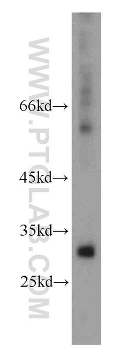 KIR2DS4 Rabbit anti-Human, Polyclonal, Proteintech:Antibodies:Primary Antibodies