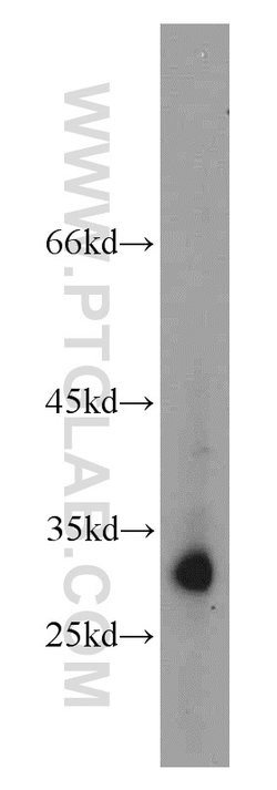 KIR2DS4 Rabbit anti-Human, Polyclonal, Proteintech:Antibodies:Primary Antibodies