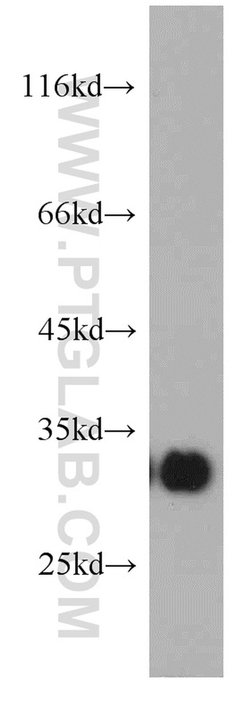 KIR2DS4 Rabbit anti-Human, Polyclonal, Proteintech:Antibodies:Primary Antibodies