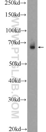 Thumbnail_TEAD2 Rabbit anti-Human, Mouse, Polyclonal, Proteintech:Anticuerpos:Anticuerpos