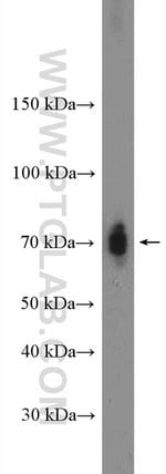 Thumbnail_TEAD2 Rabbit anti-Human, Mouse, Polyclonal, Proteintech:Anticuerpos:Anticuerpos