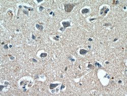 ELOVL6 Rabbit anti-Human, Mouse, Rat, Polyclonal, Proteintech:Antibodies:Primary