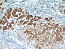 ELOVL6 Rabbit anti-Human, Mouse, Rat, Polyclonal, Proteintech:Antibodies:Primary