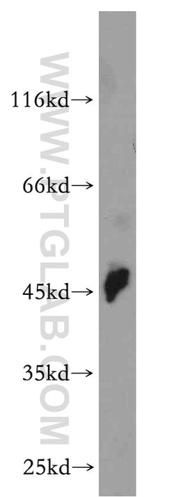 ELOVL6 Rabbit anti-Human, Mouse, Rat, Polyclonal, Proteintech:Antibodies:Primary