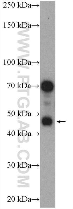 ELOVL6 Rabbit anti-Human, Mouse, Rat, Polyclonal, Proteintech:Antibodies:Primary
