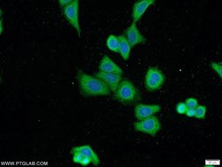 MKL1 Rabbit anti-Human, Polyclonal, Proteintech:Antibodies:Primary Antibodies