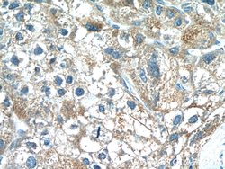 MKL1 Rabbit anti-Human, Polyclonal, Proteintech:Antibodies:Primary Antibodies