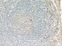MKL1 Rabbit anti-Human, Polyclonal, Proteintech:Antibodies:Primary Antibodies