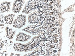 MKL1 Rabbit anti-Human, Polyclonal, Proteintech:Antibodies:Primary Antibodies