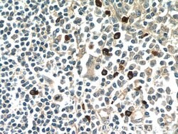 MKL1 Rabbit anti-Human, Polyclonal, Proteintech:Antibodies:Primary Antibodies