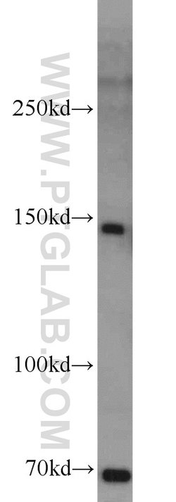 MKL1 Rabbit anti-Human, Polyclonal, Proteintech:Antibodies:Primary Antibodies
