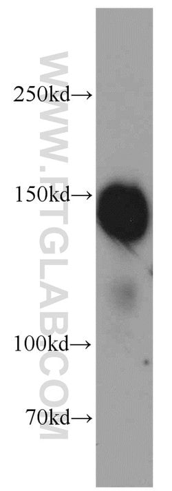 MKL1 Rabbit anti-Human, Polyclonal, Proteintech:Antibodies:Primary Antibodies