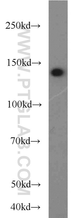 MKL1 Rabbit anti-Human, Polyclonal, Proteintech:Antibodies:Primary Antibodies