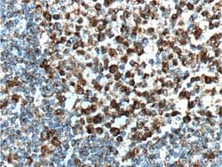 BCL6 Rabbit anti-Human, Polyclonal, Proteintech:Antibodies:Primary Antibodies