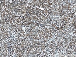 BCL6 Rabbit anti-Human, Polyclonal, Proteintech:Antibodies:Primary Antibodies