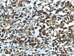 BCL6 Rabbit anti-Human, Polyclonal, Proteintech:Antibodies:Primary Antibodies