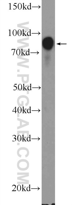 BCL6 Rabbit anti-Human, Polyclonal, Proteintech:Antibodies:Primary Antibodies