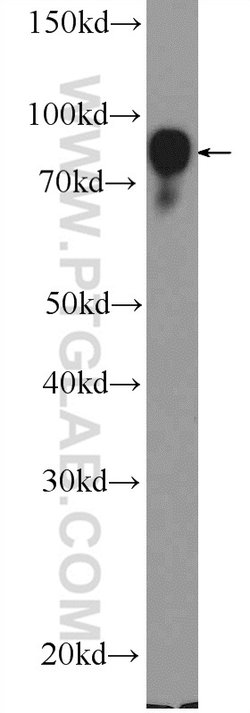 BCL6 Rabbit anti-Human, Polyclonal, Proteintech:Antibodies:Primary Antibodies