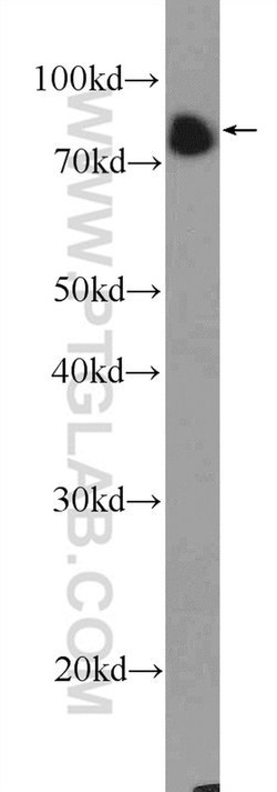 BCL6 Rabbit anti-Human, Polyclonal, Proteintech:Antibodies:Primary Antibodies
