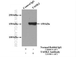 TAOK2 Rabbit anti-Human, Mouse, Rat, Polyclonal, Proteintech 150 &mu;L;
