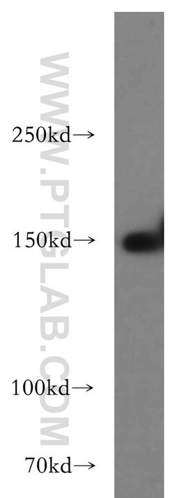 TAOK2 Rabbit anti-Human, Mouse, Rat, Polyclonal, Proteintech 150 &mu;L;