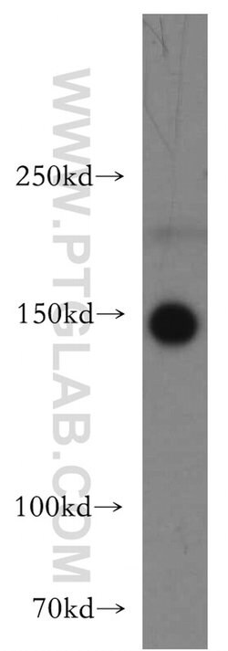 TAOK2 Rabbit anti-Human, Mouse, Rat, Polyclonal, Proteintech 150 &mu;L;