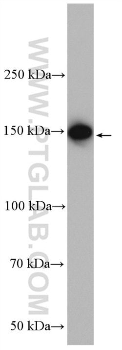 TAOK2 Rabbit anti-Human, Mouse, Rat, Polyclonal, Proteintech 150 &mu;L;