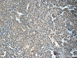 EYA3 Rabbit anti-Human, Mouse, Rat, Polyclonal, Proteintech:Antibodies:Primary