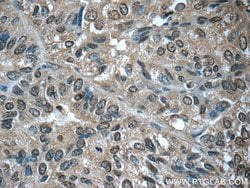 EYA3 Rabbit anti-Human, Mouse, Rat, Polyclonal, Proteintech:Antibodies:Primary