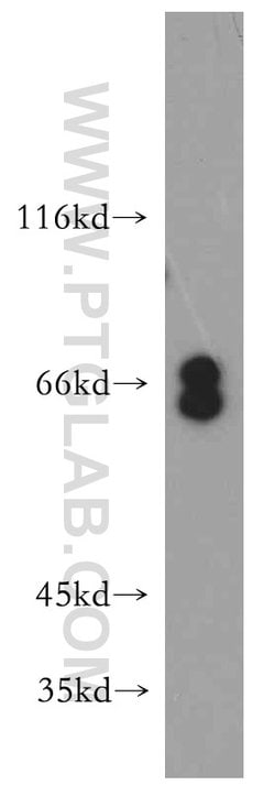 EYA3 Rabbit anti-Human, Mouse, Rat, Polyclonal, Proteintech:Antibodies:Primary