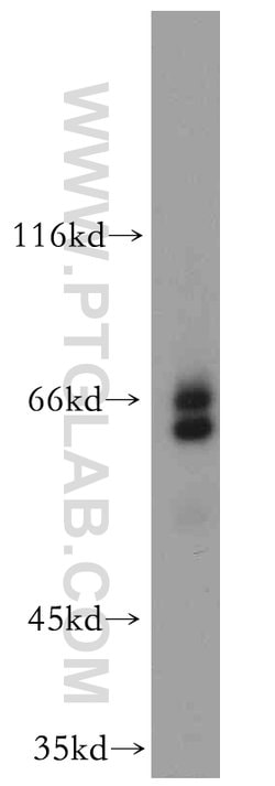 EYA3 Rabbit anti-Human, Mouse, Rat, Polyclonal, Proteintech:Antibodies:Primary