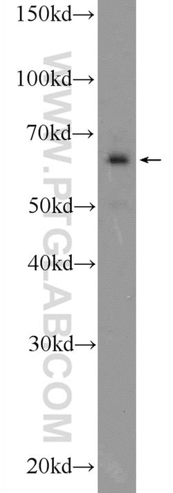EYA3 Rabbit anti-Human, Mouse, Rat, Polyclonal, Proteintech:Antibodies:Primary